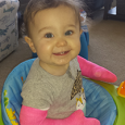 Gas Fireplaces Little Hattie shows off her pink casts.